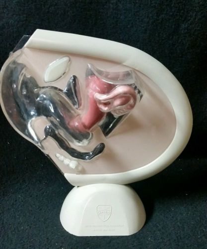 Vintage Ortho Anatomical Model Female Vagina Cervix Ovaries Pelvic