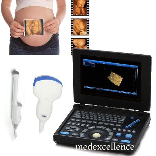 3d pc digital laptop ultrasound scanner convex+ transvaginal ce fda for sale