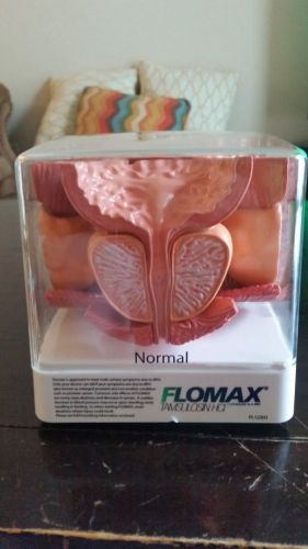 Flomax Anatomical Model Human Prostate Cancer BPH Model FL12201 Pathology
