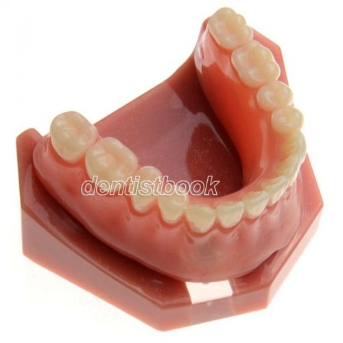New 1 Set Baistra Dental Study Teaching Model Teeth Implant Repair