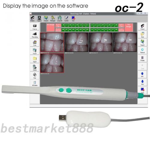 New 1/4&#034; sony ccd 4 mega pixels dental intraoral intra oral camera usb 2.0 ce for sale