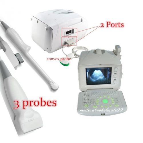 Top Sale Portable Digital Ultrasound Scanner/Diagnostic Machine with 3 Probe CE