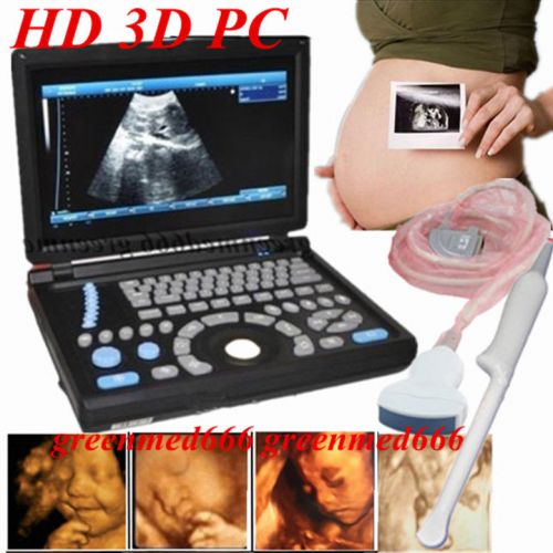 10.4inch 3D Full Digital Laptop Ultrasound Scanner+Convex &amp;Transvaginal Probe PC