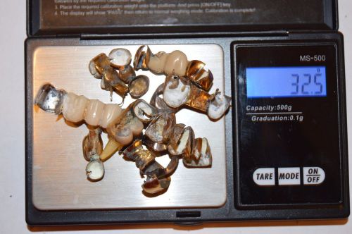 dental scrap 32.5 grams