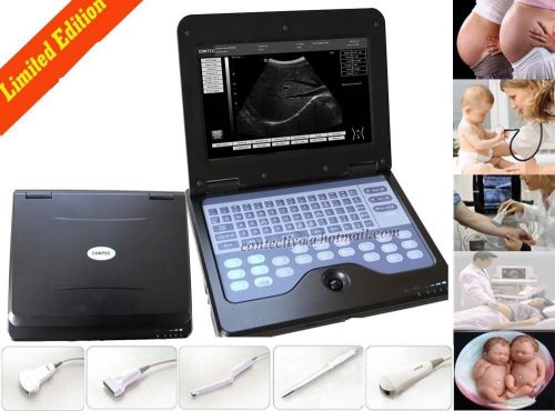 On sale!!portable hot  ultrasound diagnostic scanner machine+3.5mhz convex probe for sale