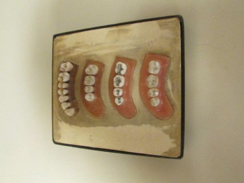 1940s Vintage Dental Operative Technics Student Mold 4 3/4&#034; x 5 1/4&#034;
