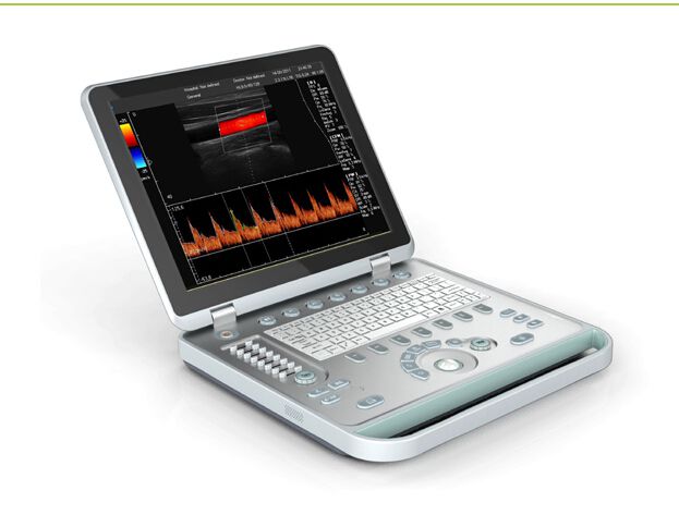 ultrasound b scanner portable laptop ultrasound machine for sale ss-8