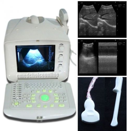 3d digital ultrasound scanner +convex tv 2 probes optional 2 probes+3 years warr for sale