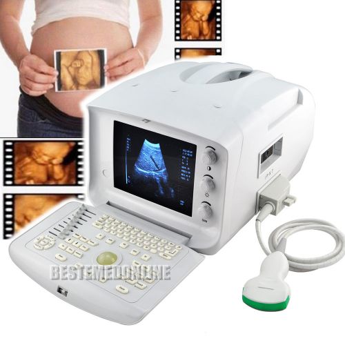 Portable Ultrasound Scanner machine system with convex probe+free 3D software