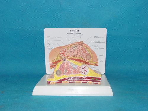 Rs female breast anatomical model cross-section lesion anatomy teach education for sale