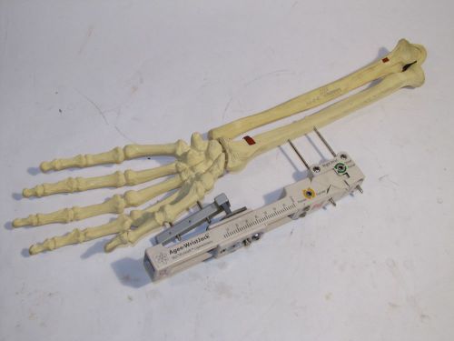 AGEE WRISTJACK MULTIPLANAR LIGAMENTOTAXIS with SAWBONES 1022 HAND WRIST MODEL