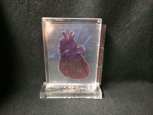 Transparent Heart Anatomical Model with Pull out tabs.