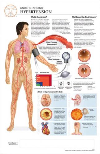 11 x 17 post-it disease chart: hypertension for sale