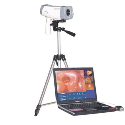 Digital video electronic colposcope sony 480,000 pixels for gynecologic exam for sale