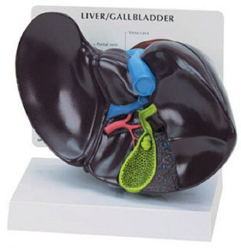 Anatomical Human Liver Gallbladder Model OVERSTOCK RETURNED BY CUSTOMER