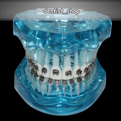 Blue Dental Orthodontics Study Teeth Model with Full Metal Brackets #3001