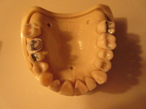 Model Typodent For Dental Practice Drilling Teeth Placeing Fillings