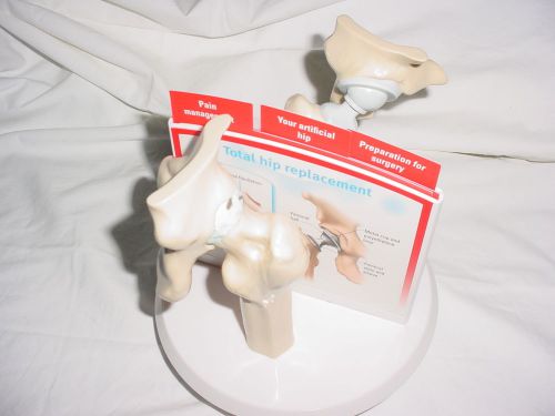Ortho-McNiel Osteoarthritis of the Hip &amp; Total Hip Replacement Model