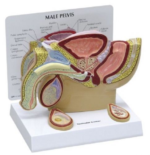 Anatomical Human Male Pelvis Testicular Cancer Model OVERSTOCK RETURNED