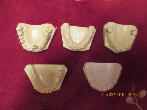 Dental Orthodontics &amp; Pedodontics Demonstration Models, set of 5.