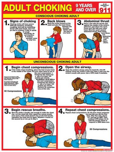 Adult choking first aid instructional wall chart poster (arc-aha guidelines) for sale