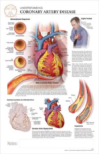 11 x 17 post-it disease chart: acute coronary disease for sale