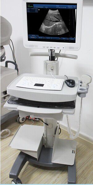 Best Ultrasound SS-100 Touch Screen 3D Trolley medical imaging equipment Ultrasound Diagnosis B Scanner