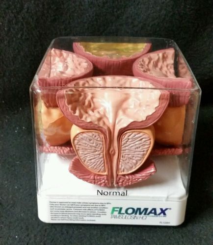 Vintage Flomax Anatomical Model Prostate Cancer FL12201 Urinary Bladder
