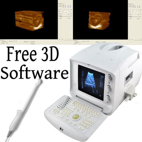 FDA CE Digital Ultrasound Machine/Scanner Trans vaginal Probe 3D Workstation
