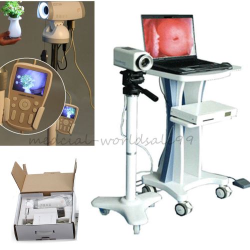 Dhl/ups digital 830.000 pixels sony camera electronic colposcope+tripod cart set for sale