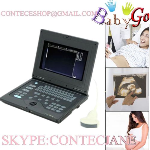 New laptop , b-ultrasound scanner with 3.5convex probe cms600p for sale