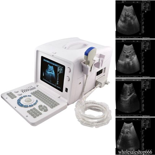 3.5 Mhz Convex Probe +Portable Digital Ultrasound Scanner Machine System Free 3D