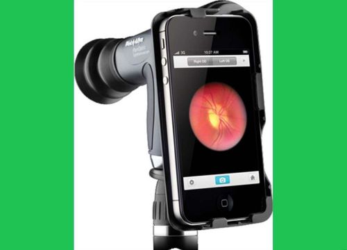 Welch Allyn iExaminer Adopter for PanOptic Ophthalmoscope LABGO