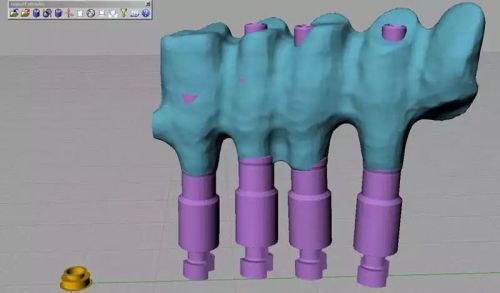 Dental CAD File To stl Conversation Software Dental Shaper . CAD/CAM