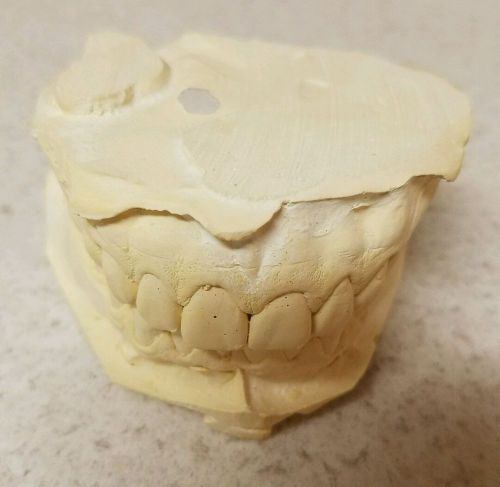 A dental mold of my teeth