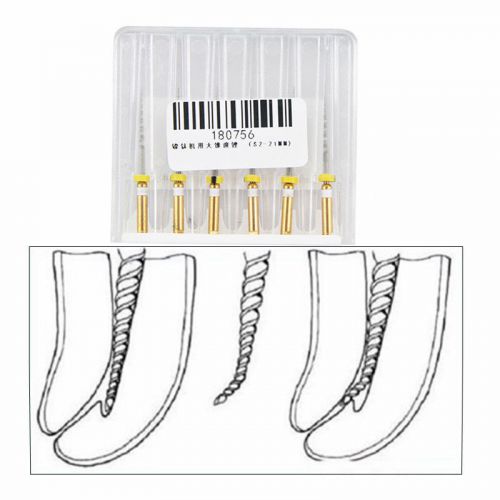 6pcs Dental Endodontic Niti Rotary Files Universe Engine S2 21MM Endo Root Canal