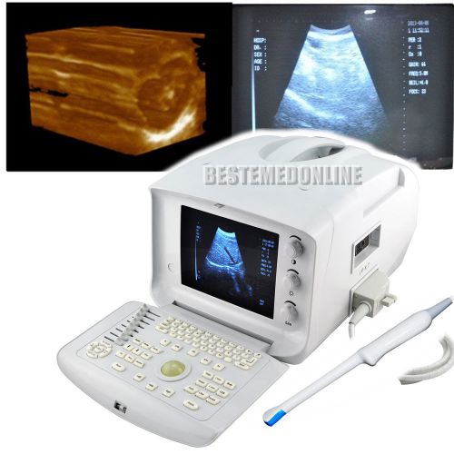 New Free 3D work stationPortable Ultrasound Scanner Machine Transvaginal Probe
