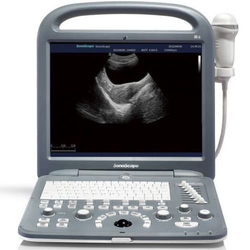 SonoScape S2 Portable Color Doppler System