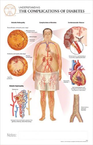 11x17 Post-It Disease Chart: COMPLICATIONS OF  DIABETES