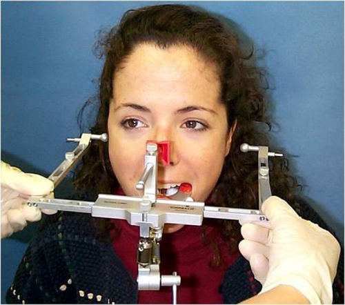 Dental oral basic system facebow bitefork transfer assembly jaw occlusal lab bs