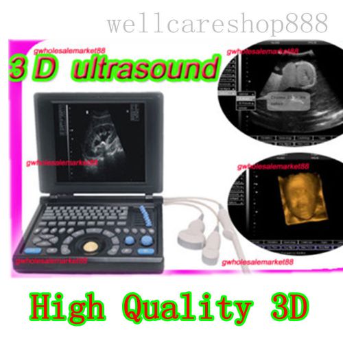 Fda 3d full digital laptop ultrasound scanner 10.4&#034; diagnostic system pc bid buy for sale