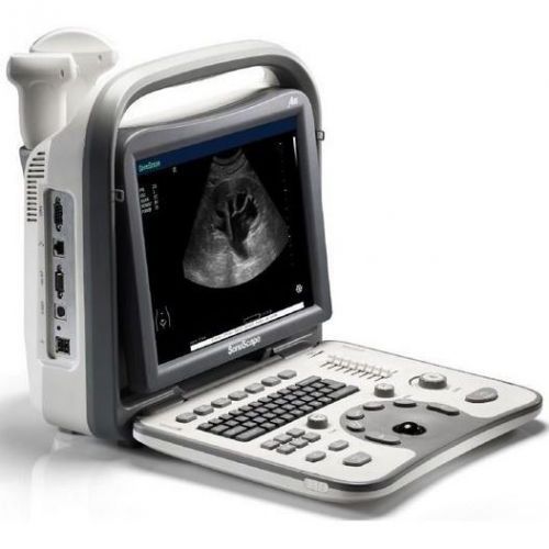 SonoScape A6 Portable Ultrasound System