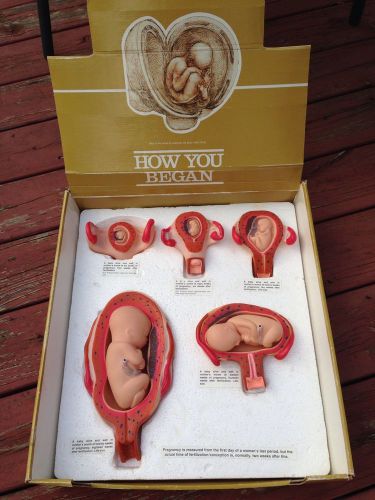 Pregnancy  - Embryo Fetus Model How You Began-Set/5 Display-Anatomically Baby
