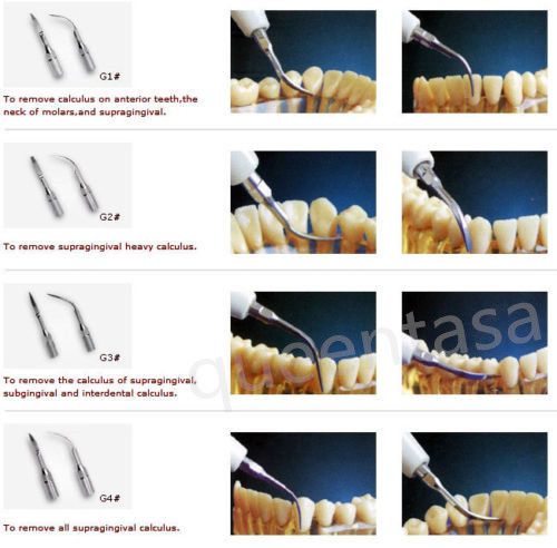 4pc Hot Sale Dental Ultrasonic Scaler Scaling Tip G1 G2 G3 G4 For EMS WOODPECKER