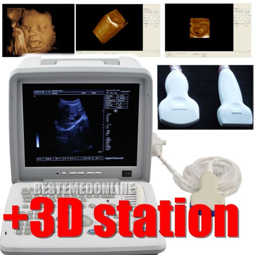 12.1 full digital portable ultrasound scanner +convex + linear (2 probe) + 3d for sale