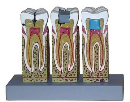 DEMODENT Anatomical Dentist Dental Teeth Tooth Model