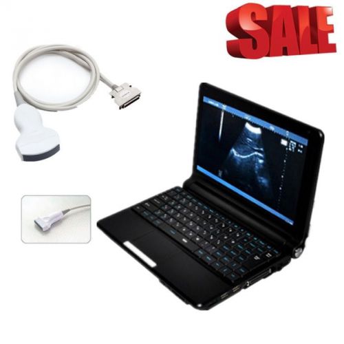 Factory! Ultrasound Scanner machine Laptop with One Probe for Human or Animal