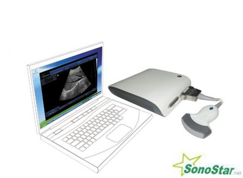 Ultrasound B Scanner  Portable B Scanner  Ultrasound B Scanner Box 3D imaging