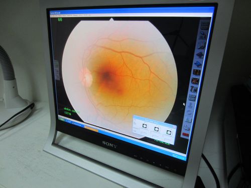 Digital Kowa VX-10  Fundus Camera Mydriatic, FA, Digital with Computer, printer