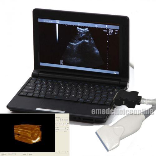 Medical portable notebook laptop ++3d ultrasound machine scanner+7.5mhz linear for sale